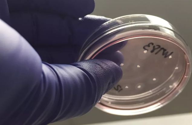 Estudo liderado por brasileiro bloqueia doença neurológica com 'minicérebros' e remédio contra HIV